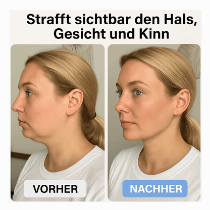 Lumina – Luxus Lifting - Technologie für strahlende Haut